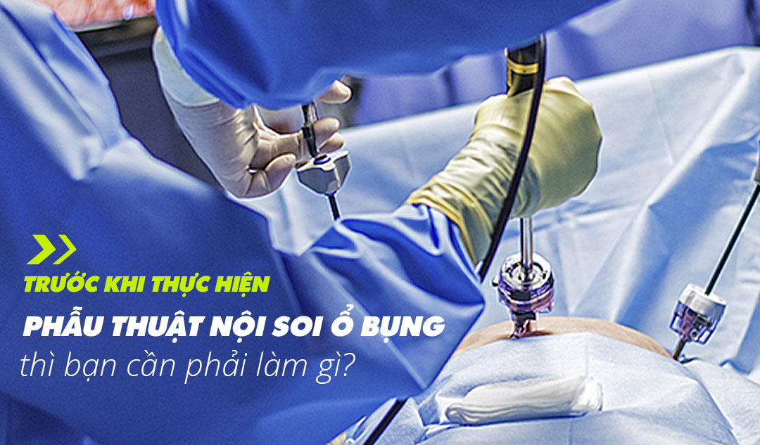 Trước khi thực hiện phẫu thuật nội soi ổ bụng thì bạn cần phải làm gì?