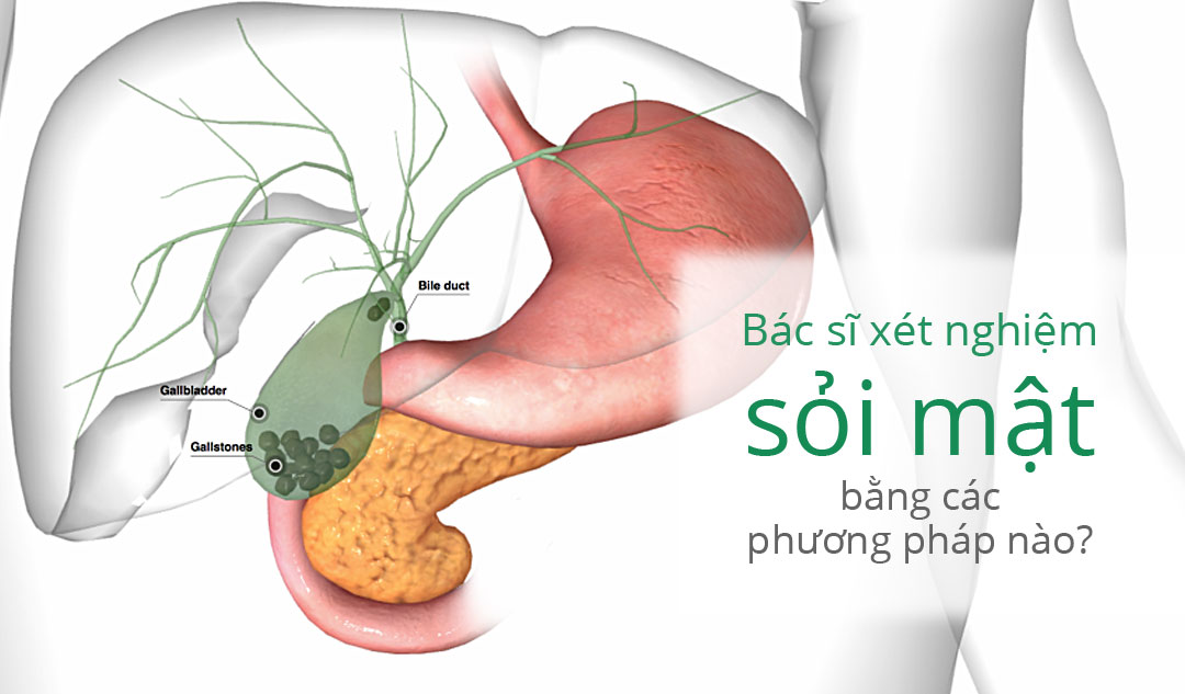 Bác sĩ xét nghiệm sỏi mật bằng các phương pháp nào?