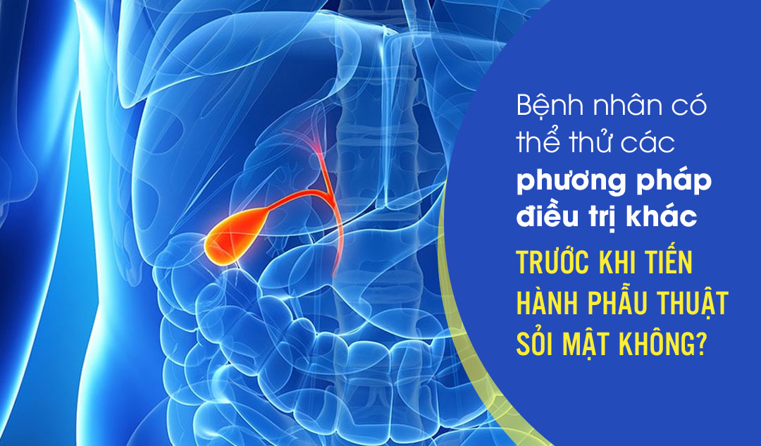 Bệnh nhân có thể thử các phương pháp điều trị khác trước khi tiến hành phẫu thuật sỏi mật không?