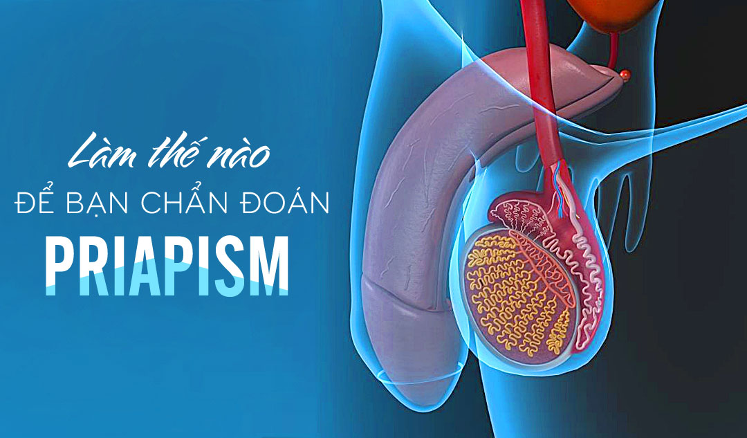 Làm thế nào để bạn chẩn đoán priapism?