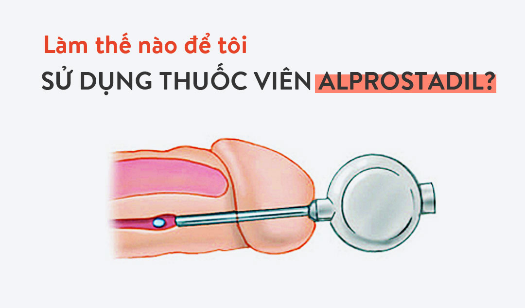 Làm thế nào để tôi sử dụng thuốc viên alprostadil?