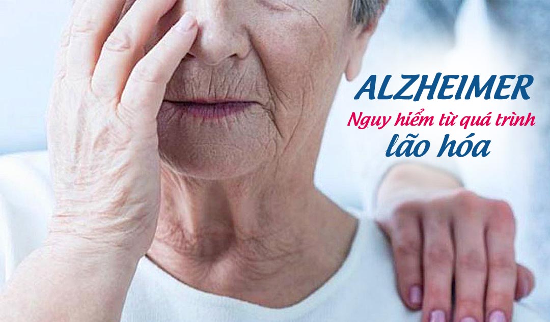 Bệnh Alzheimer - Nguy hiểm từ quá trình lão hóa