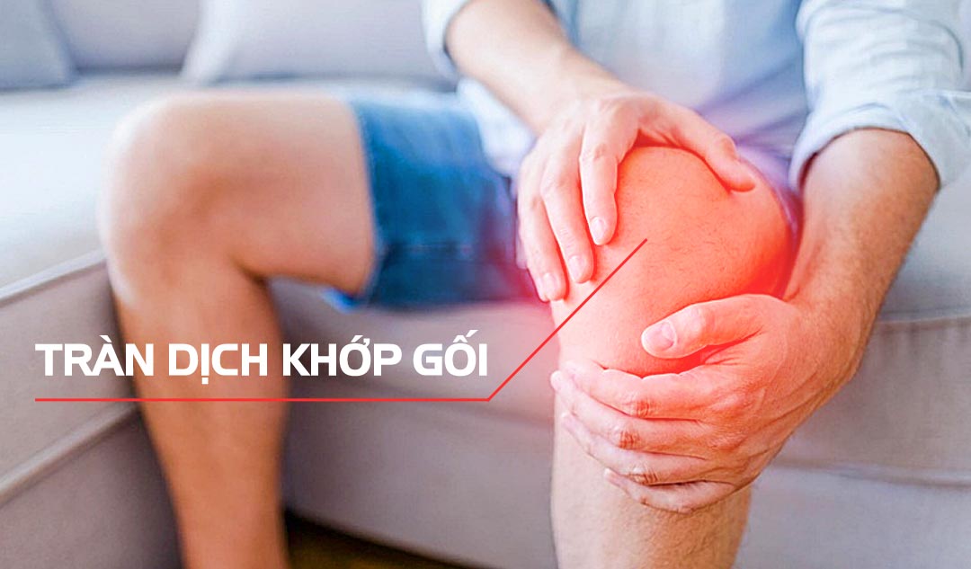 Bệnh Tràn Dịch Khớp Gối