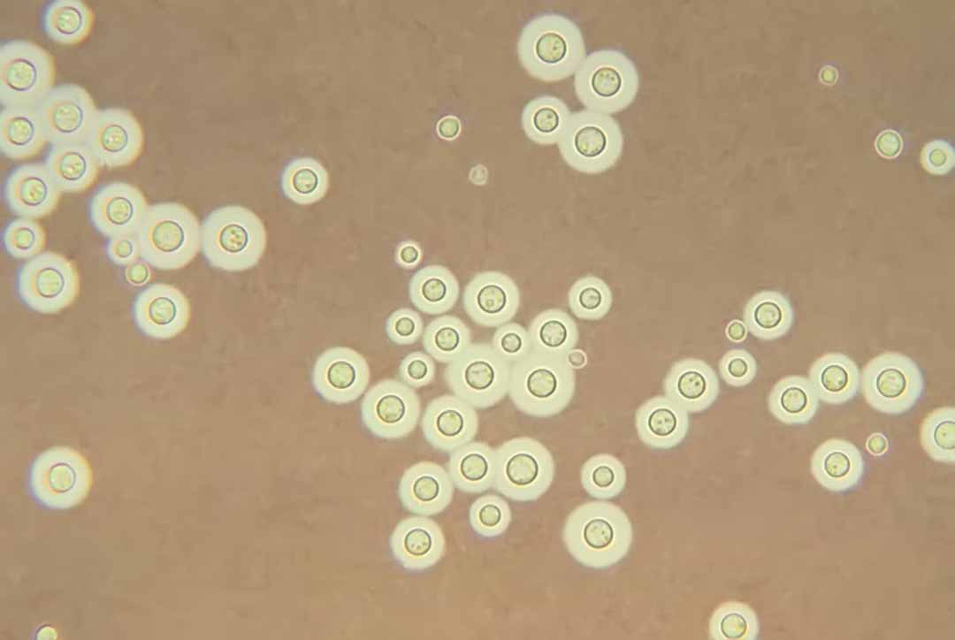 Nhiễm Nấm Cryptococcus