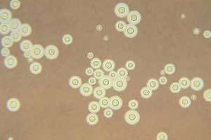Nhiễm Nấm Cryptococcus