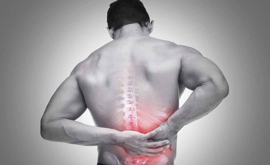 Khái niệm về thuật ngữ đau lưng