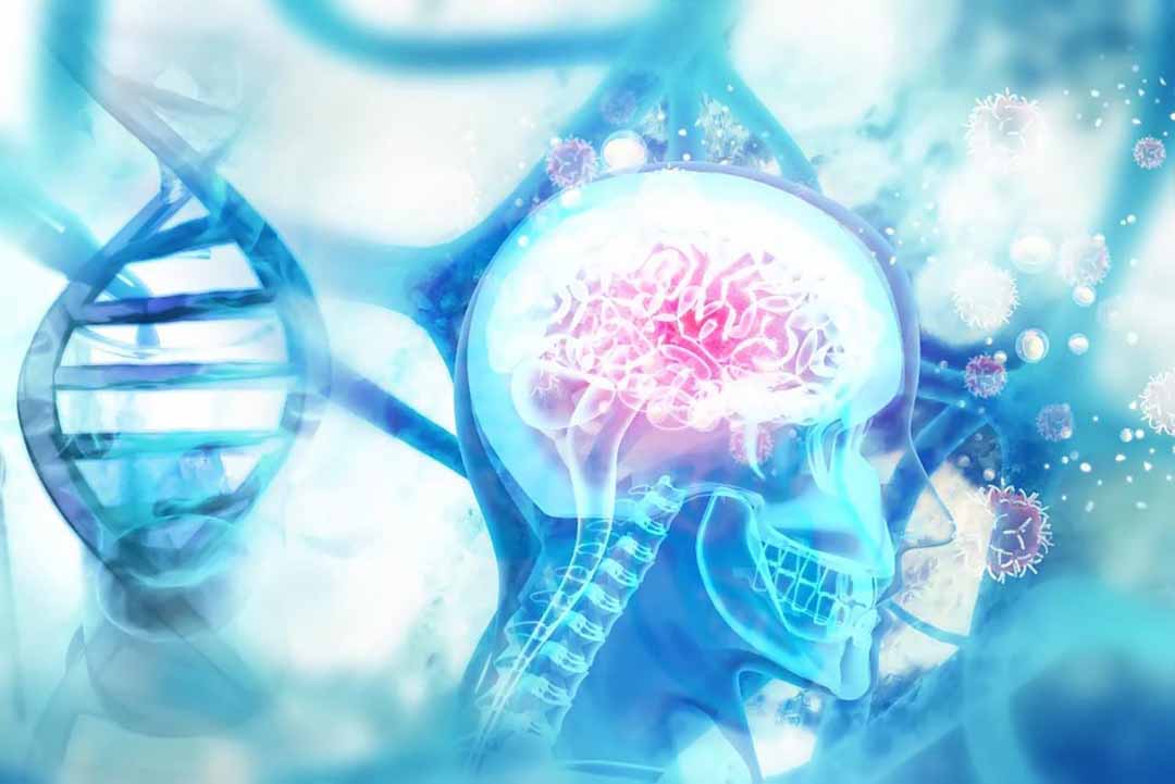 Phát hiện gen gây ra bệnh Alzheimer