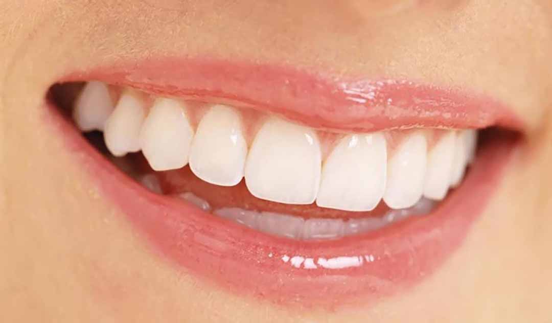 Một số vấn đề lưu ý để có một hàm răng chắc khỏe