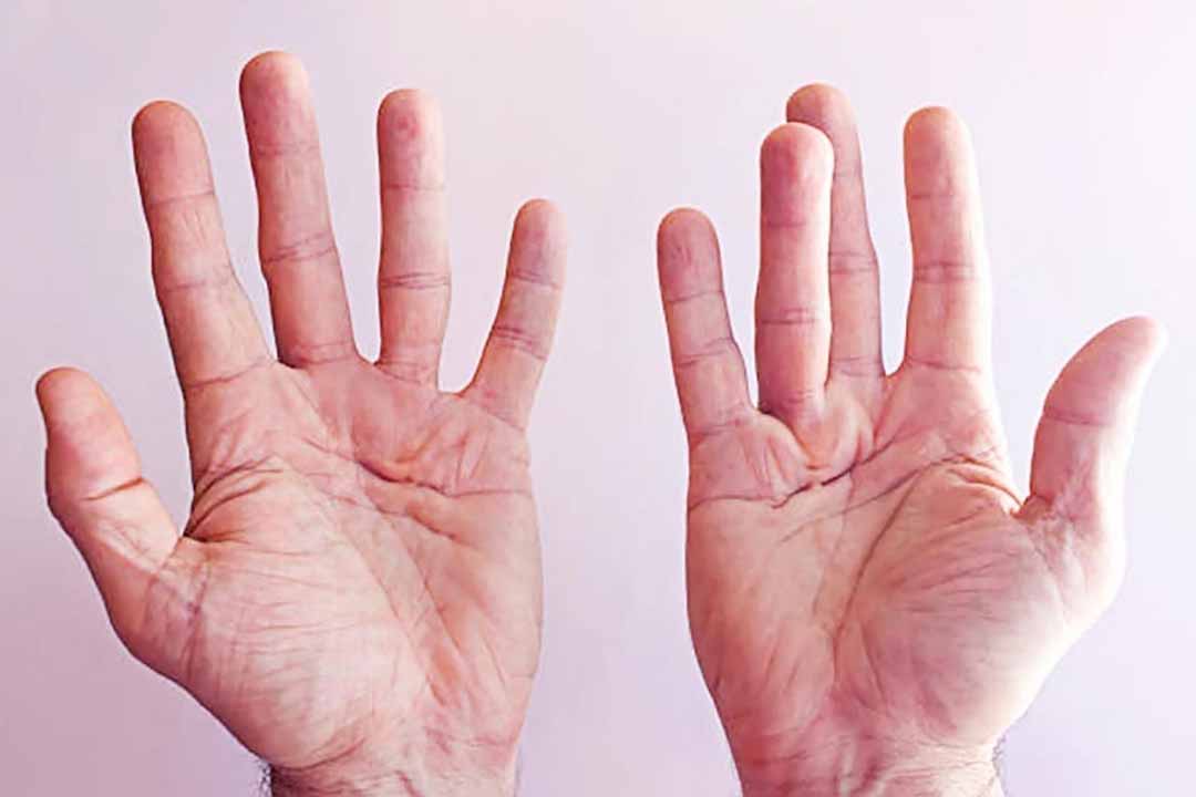 Khi bạn già đi sức mạnh bàn tay sẽ như thế nào?