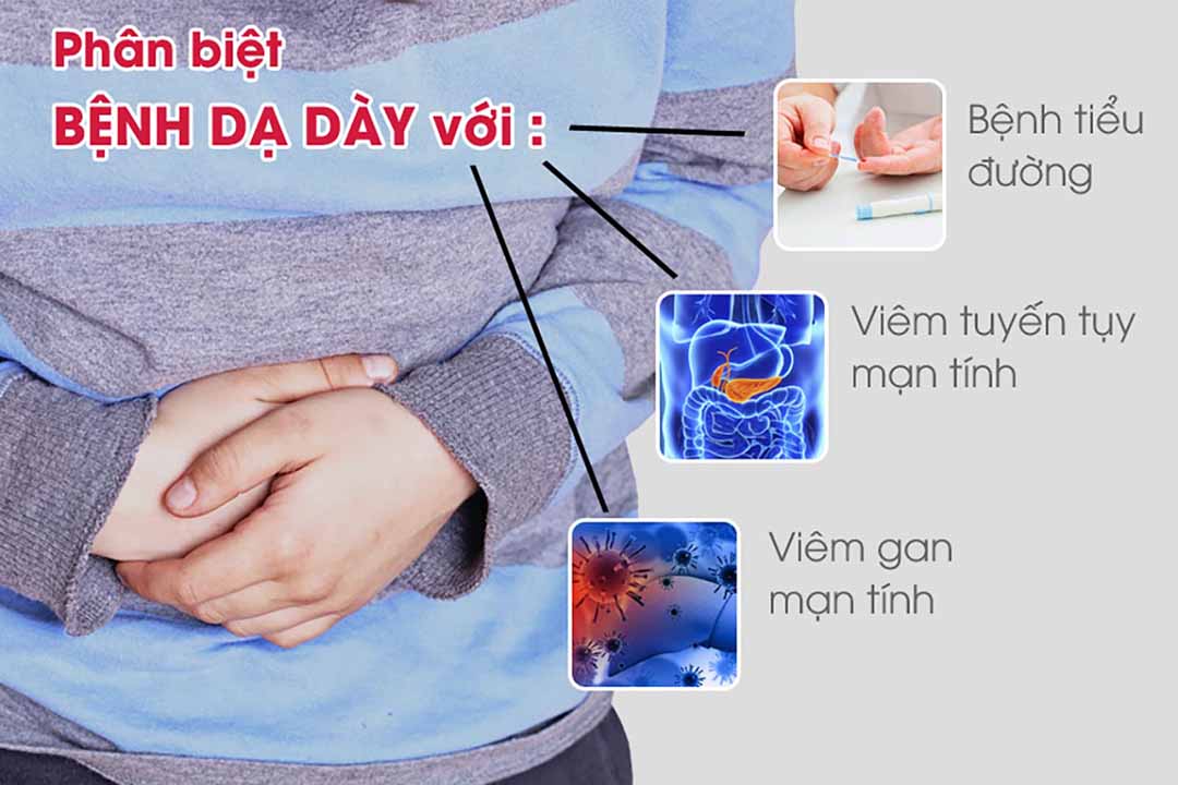 Chẩn đoán phân biệt bệnh dạ dày với các bệnh khác