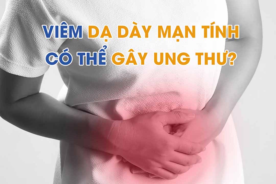 Tổng quan viêm dạ dày mạn tính