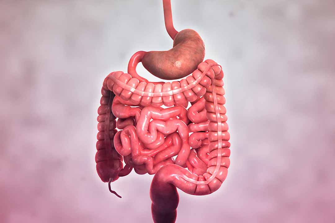 Bệnh crohn thường có biểu hiện ra sao?