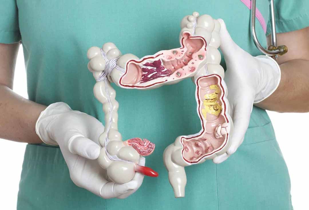 Yếu tố di truyền có liên quan đến bệnh loét đường ruột ở trẻ em hay không?