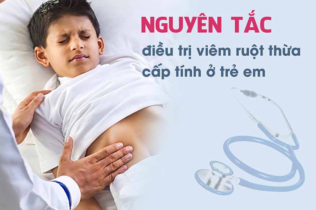 Nguyên tắc điều trị viêm ruột thừa cấp tính ở trẻ em là gì?