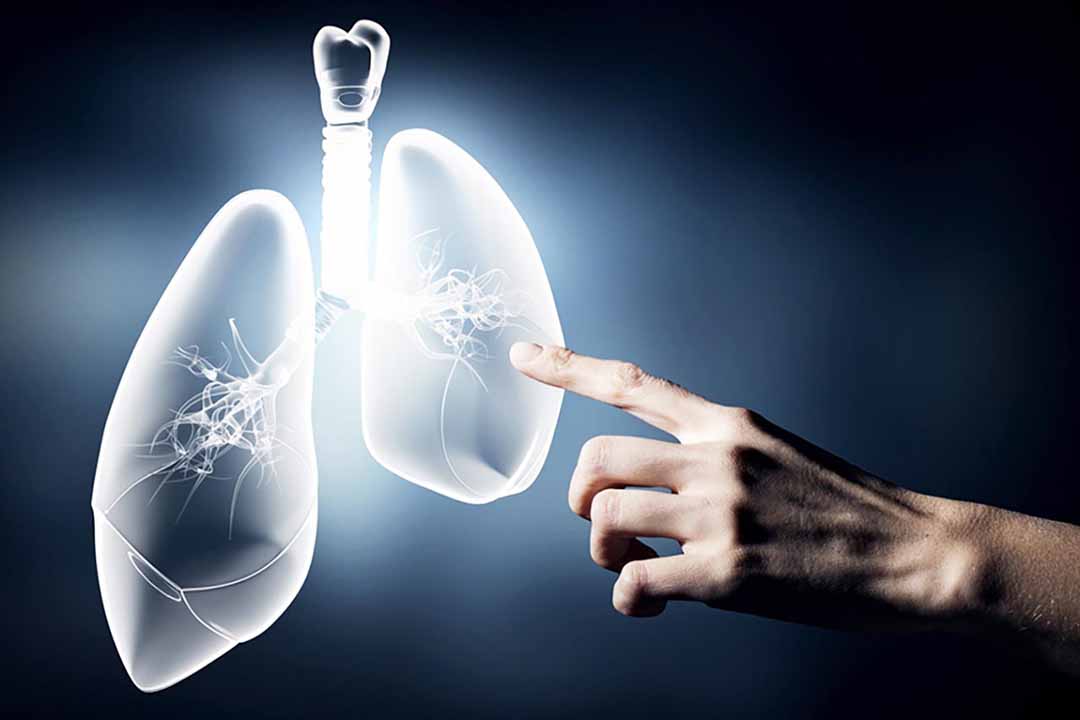 Trong tương lai ung thư phổi được quan tâm như thế nào?