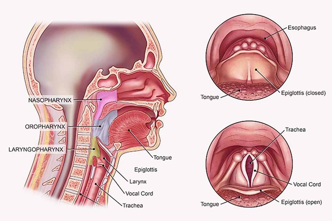 Ung thư họng miệng, nguyên nhân và các loại thường gặp