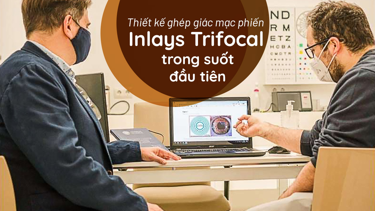 Các nhà nghiên cứu đã thiết kế ghép giác mạc phiến Inlays Trifocal trong suốt đầu tiên