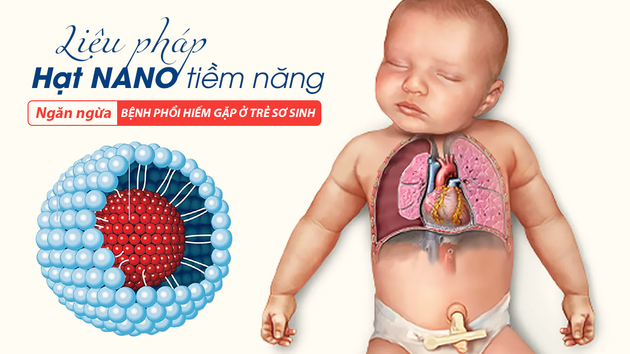 Liệu pháp hạt nano tiềm năng trong việc ngăn ngừa bệnh phổi hiếm gặp ở trẻ sơ sinh