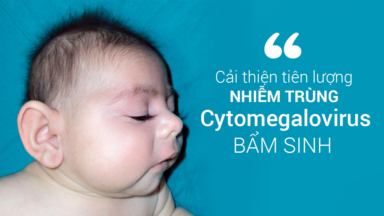 Liệu pháp cho thai nhi và trẻ sơ sinh cải thiện tiên lượng nhiễm trùng cytomegalovirus bẩm sinh