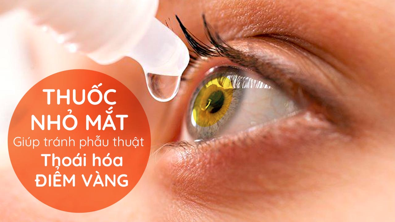 Thuốc nhỏ mắt có thể giúp đóng các lỗ hoàng điểm, giúp một số bệnh nhân tránh phải phẫu thuật thoái hóa điểm vàng