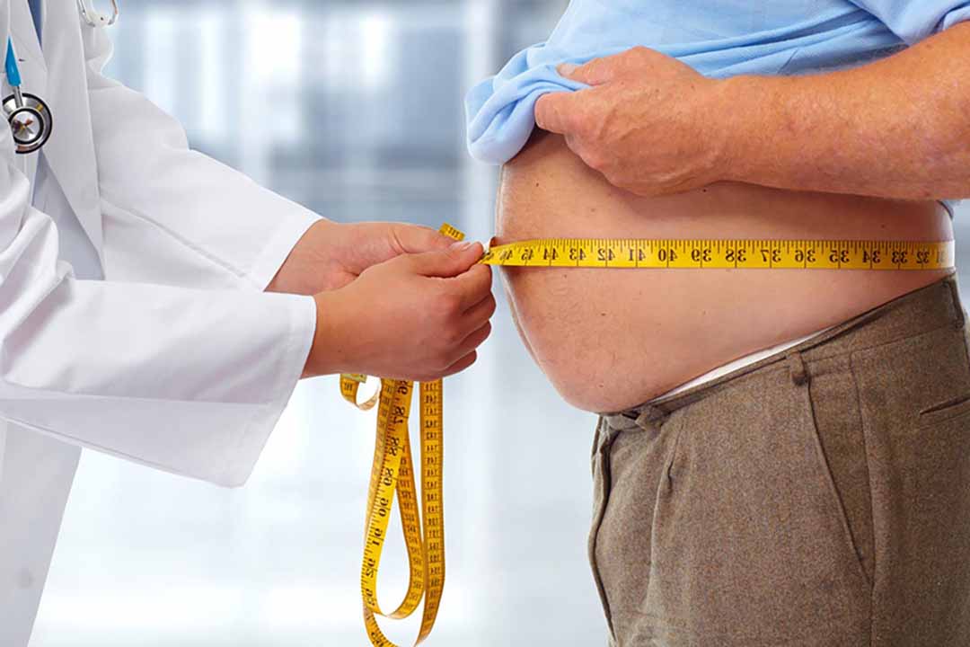 Thực trạng người mắc bệnh béo phì hiện nay