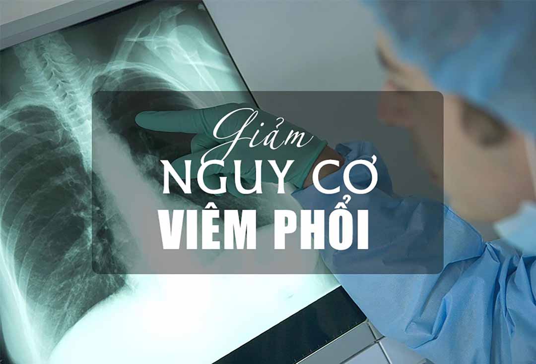 Giảm nguy cơ viêm phổi khi nằm viện