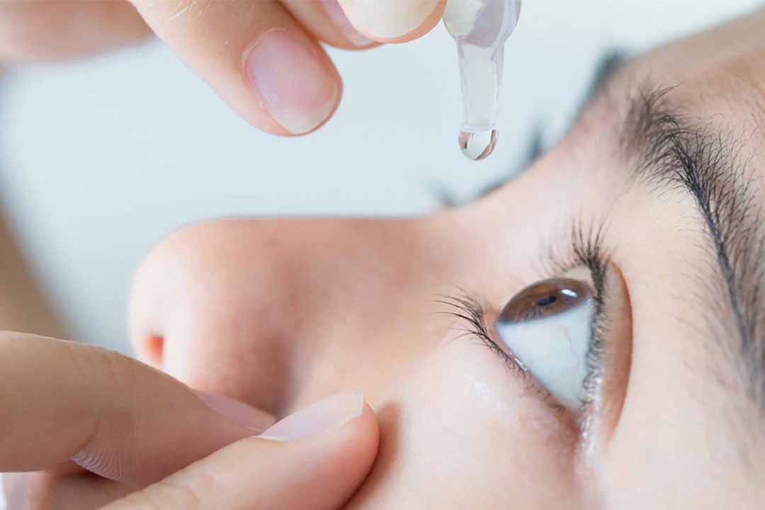 Thuốc nhỏ mắt nào giúp trị dị ứng mắt?