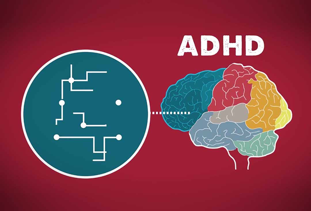 Bạn có bị ADHD không?