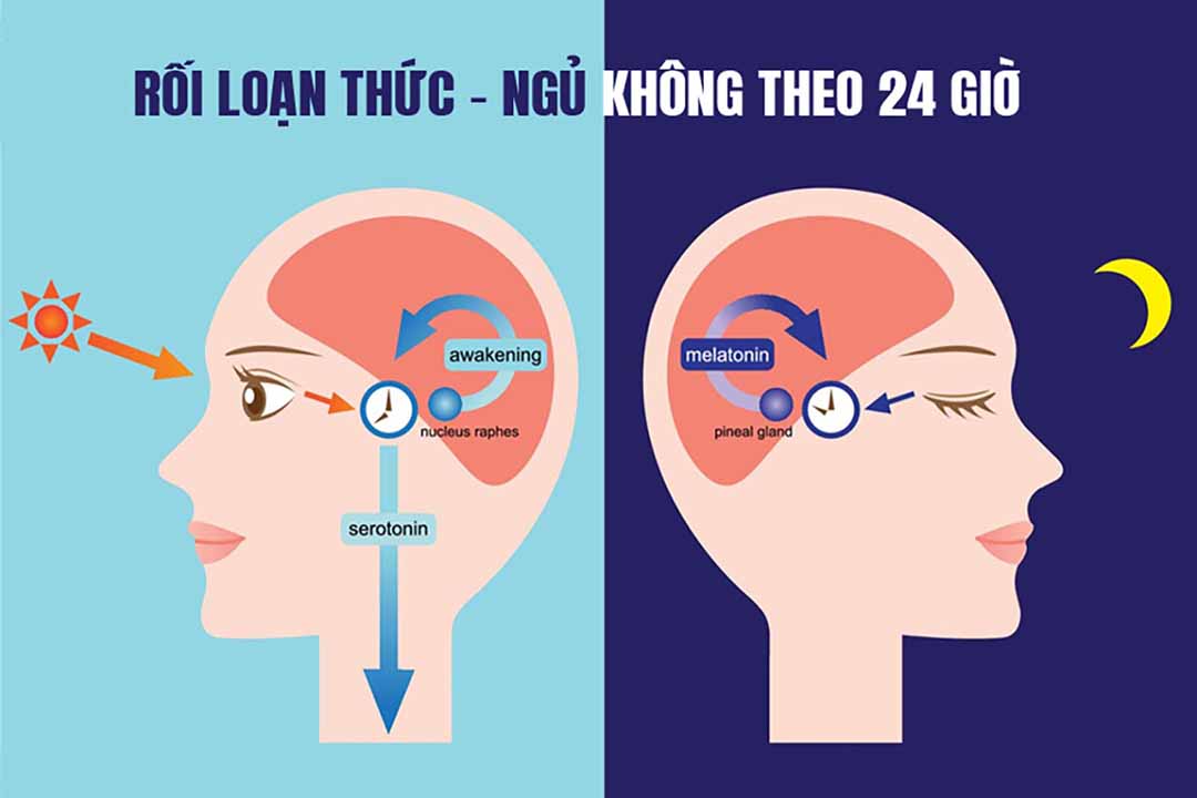 Rối loạn thức - ngủ không theo 24 giờ (Non-24-Hour Sleep-Wake Disorder)