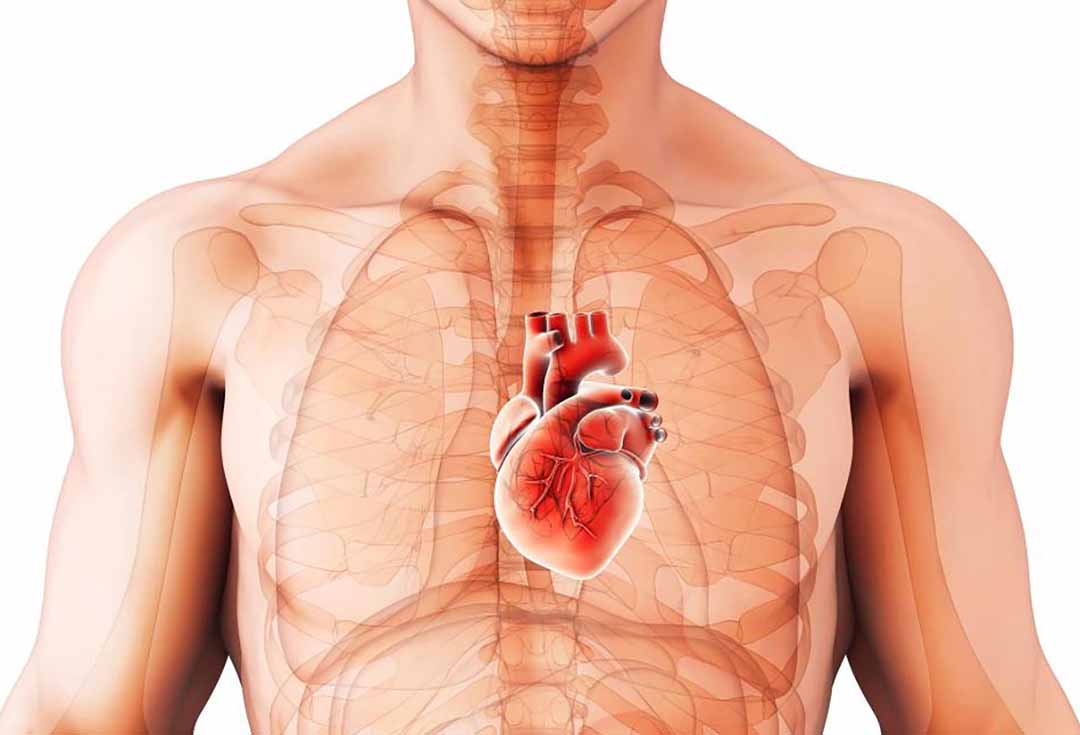 Chứng tim to (Cardiomegaly)