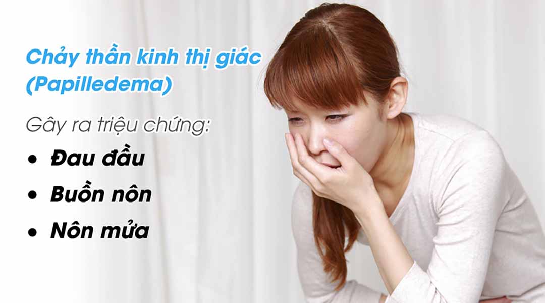 Các triệu chứng thường thấy ở Papilledema.