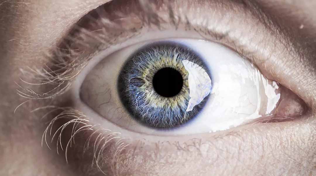 Đột quỵ mắt: nguyên nhân, triệu chứng và điều trị