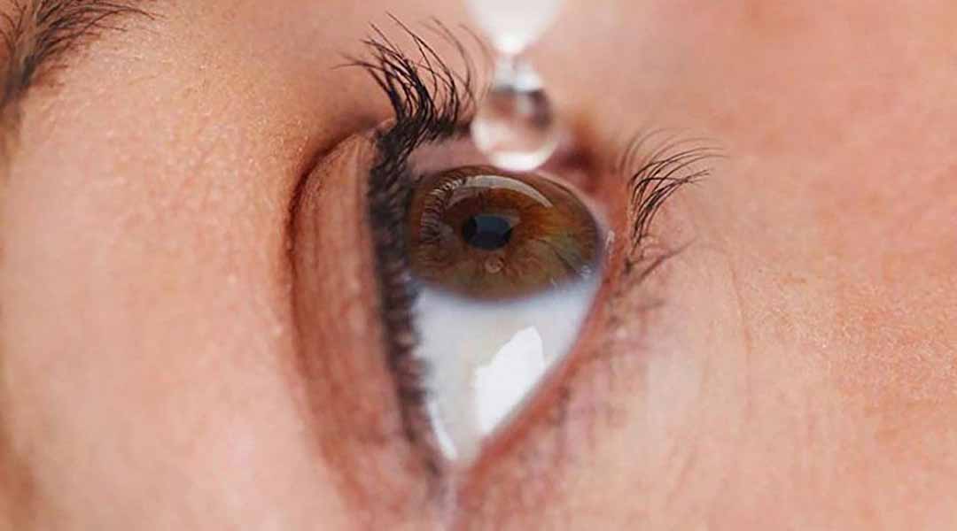 Nhỏ thuốc nhỏ mắt ngăn trạng tình trạng khô mắt tồi tệ hơn.