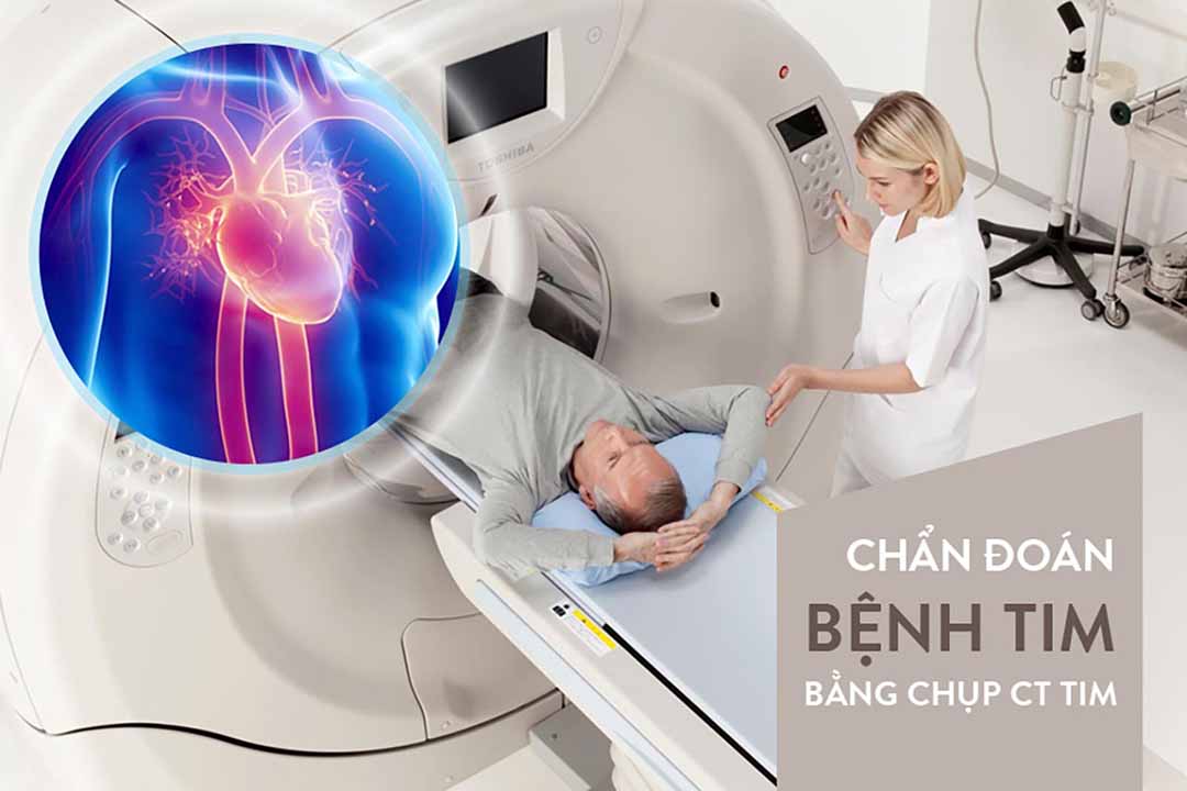 Chẩn đoán bệnh tim bằng chụp CT tim