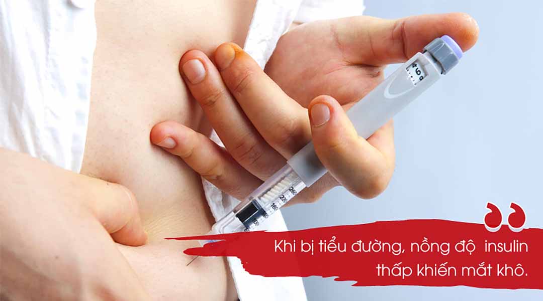 Lượng insulin trong cơ thể thấp dẫn đến mắt khô.