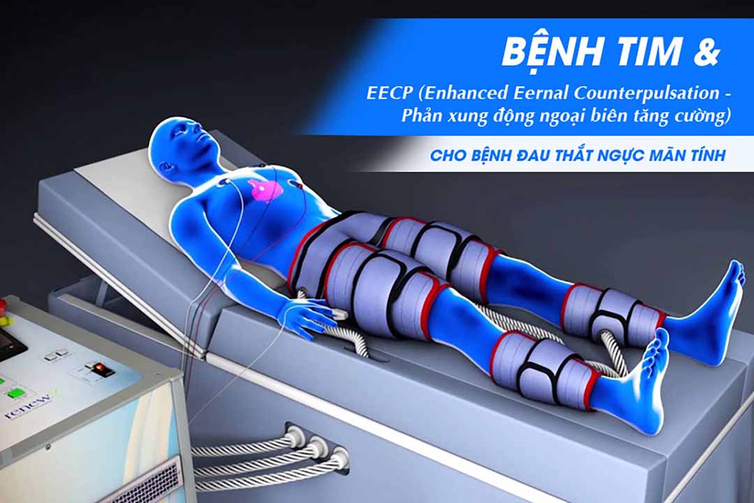 Bệnh tim và EECP (Enhanced Eernal Counterpulsation - Phản xung động ngoại biên tăng cường) cho bệnh đau thắt ngực mãn tính