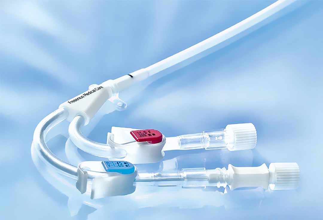 Catheter - Ống nhựa mỏng, dẻo, được đưa vào bàng quang qua dương vật / niệu đạo để dẫn lưu nước tiểu.