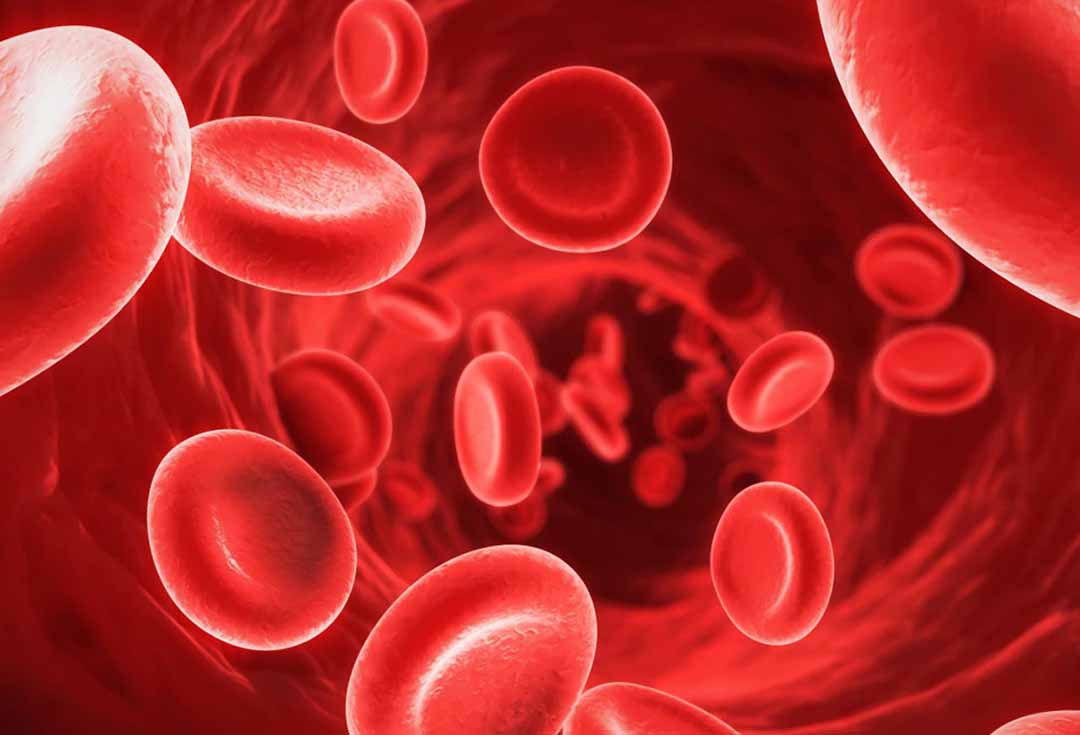 Không đủ hồng cầu gây ra thiếu máu trong cơ thể.