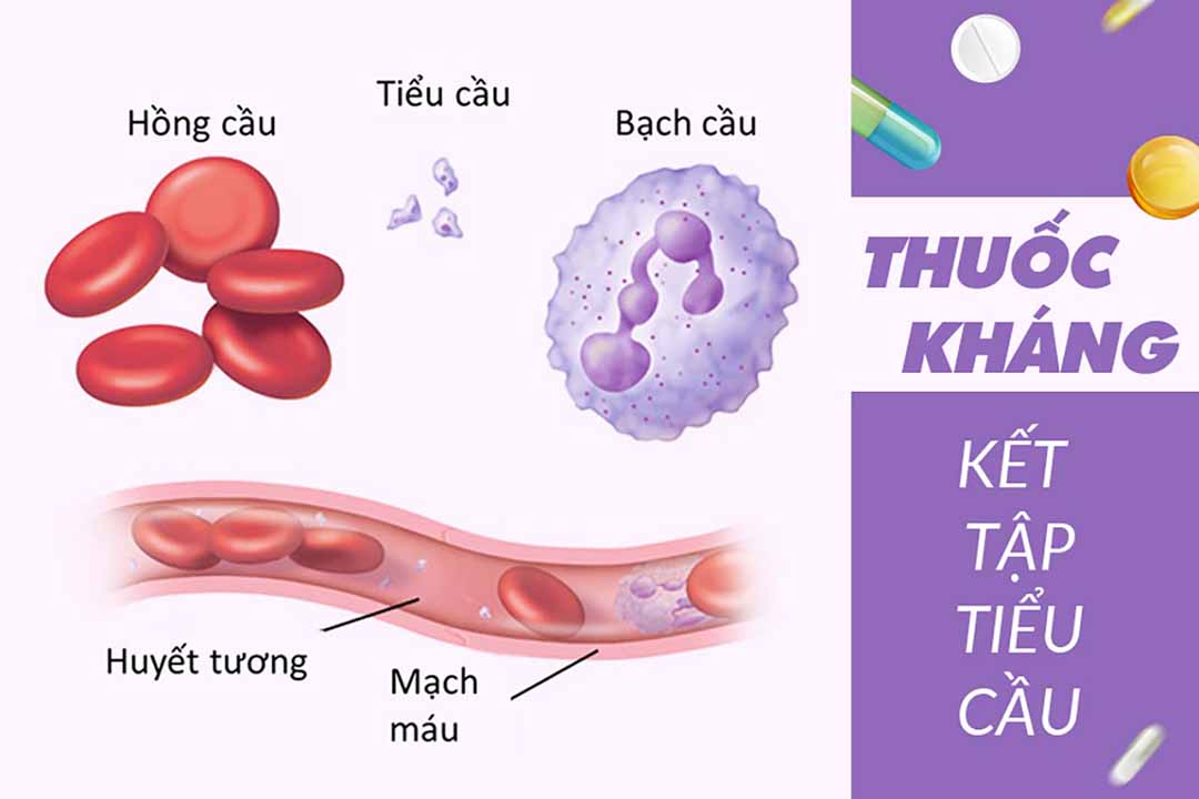 Bệnh tim và thuốc kháng kết tập tiểu cầu