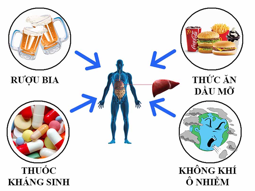 Do chế độ ăn uống không lành mạnh, sử dụng thuốc kháng sinh thường xuyên.