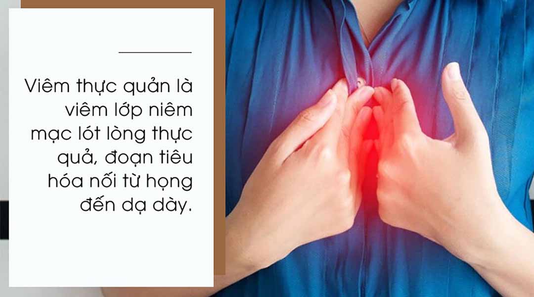 Bệnh Viêm Thực Quản