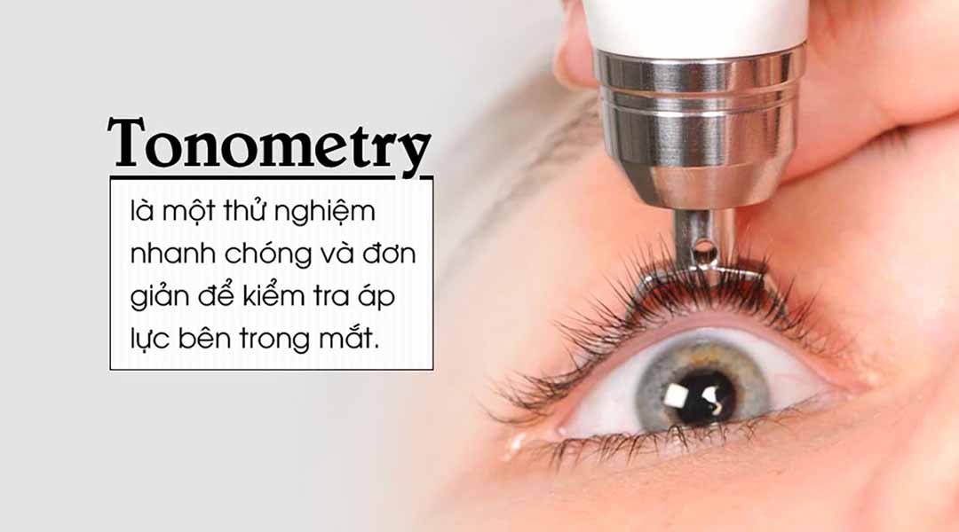 Kiểm tra mắt Tonometry là gì?