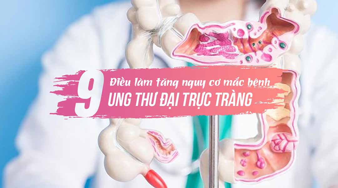 Ung thư đại trực tràng: 9 điều làm tăng nguy cơ mắc bệnh của bạn