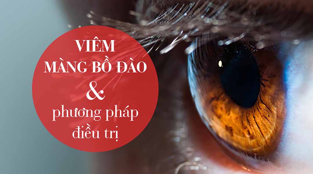 Phương pháp điều trị viêm màng bồ đào: Thuốc, phẫu thuật và giảm các triệu chứng