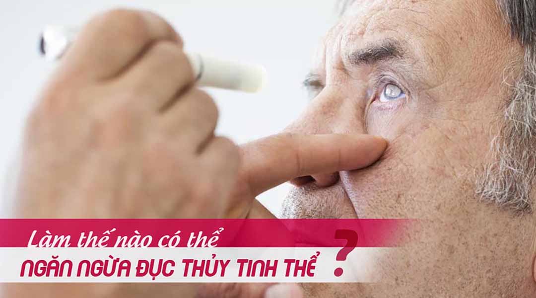 Làm thế nào có thể ngăn ngừa đục thủy tinh thể?