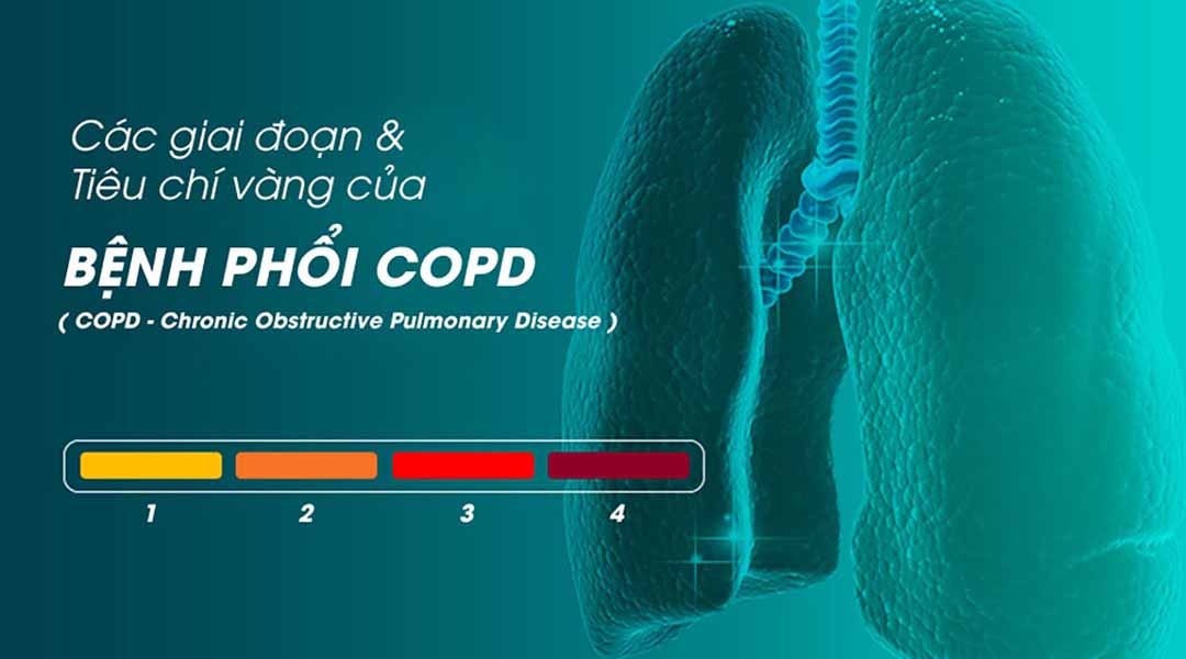 Các giai đoạn và tiêu chí vàng của bệnh phổi tắc nghẽn mạn tính (COPD - Chronic Obstructive Pulmonary Disease)