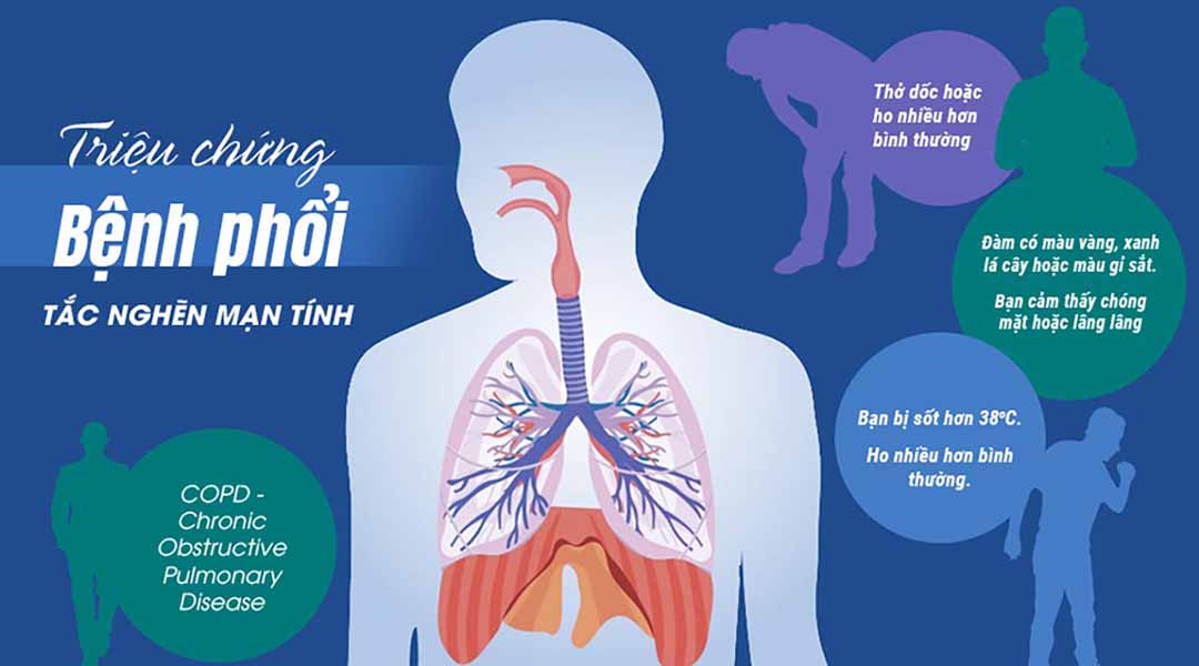 Triệu chứng bệnh phổi tắc nghẽn mạn tính (COPD - Chronic Obstructive Pulmonary Disease)