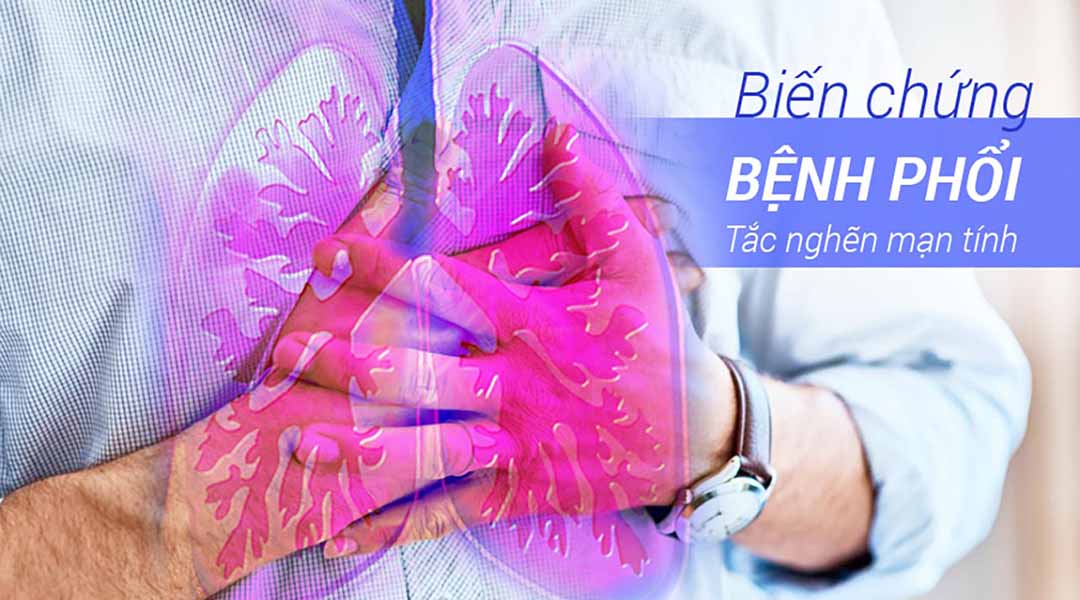 Biến chứng từ bệnh phổi tắc nghẽn mạn tính (COPD - Chronic Obstructive Pulmonary Disease)