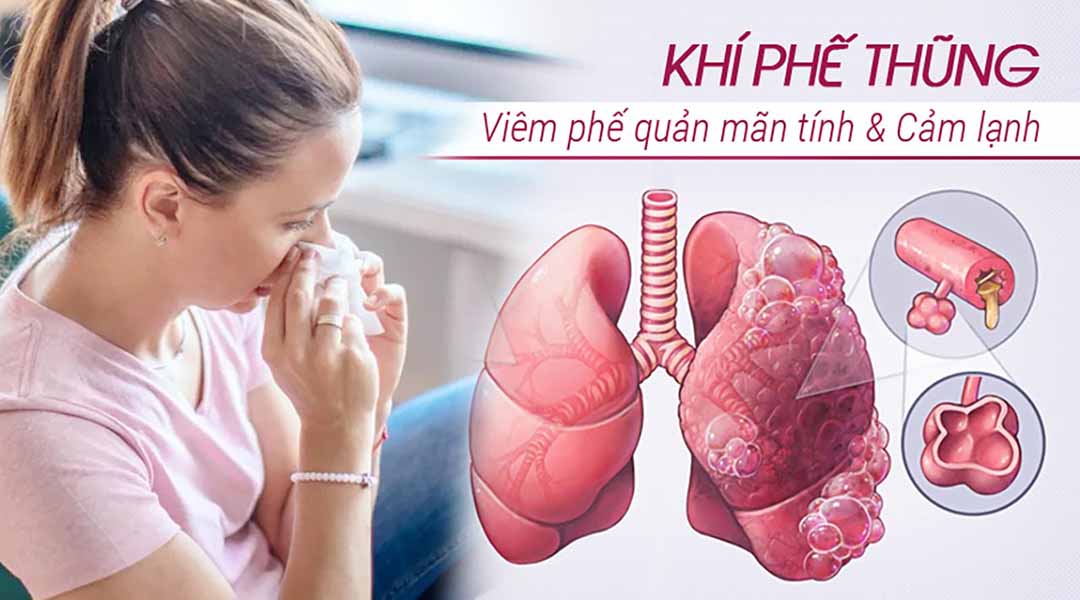 Khí phế thũng, viêm phế quản mãn tính và cảm lạnh