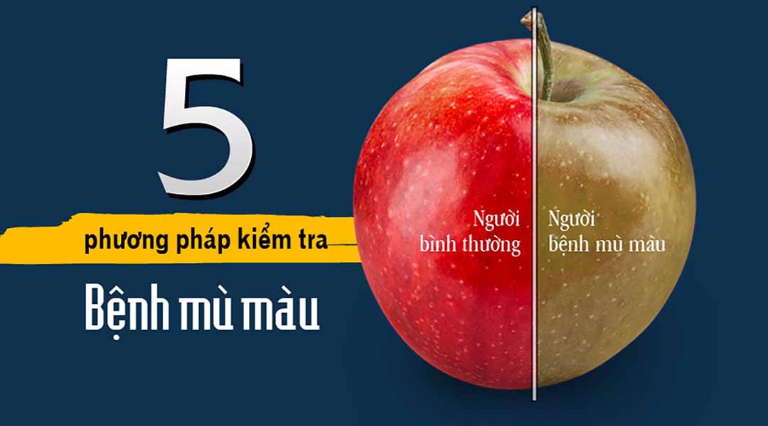 5 phương pháp kiểm tra bệnh mù màu